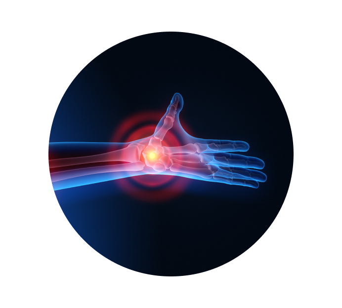 Рентген лучезапястного сустава