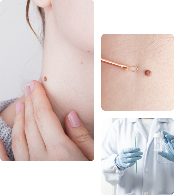 Осложнения после прививки от ВПЧ Осложнения после прививки от ВПЧ