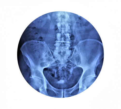 Рентген брюшной полости