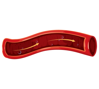 УЗИ сосудов