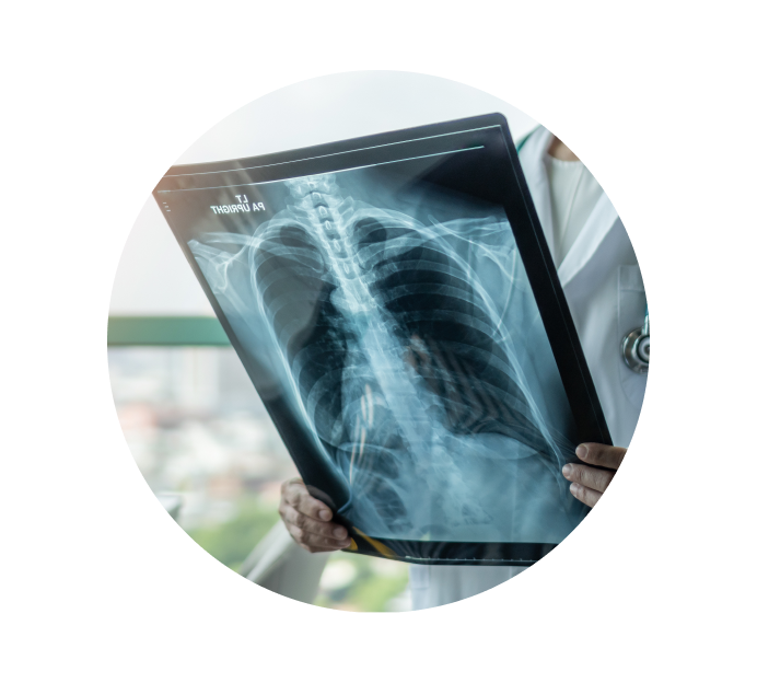 Рентген пищевода