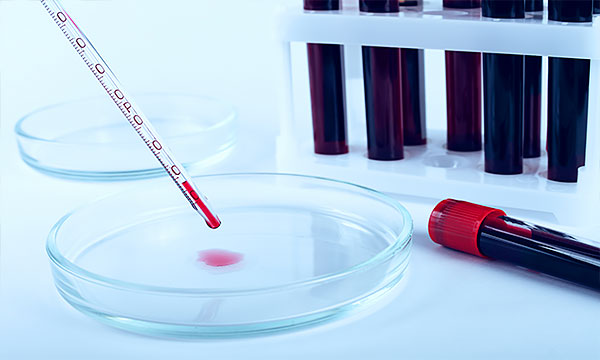 Взятие крови из периферической вены/из пальца Взятие крови из периферической вены/из пальца