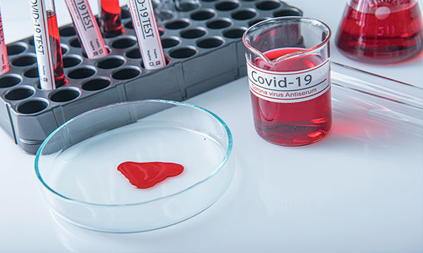 Экспресс-тестирование для обнаружения антигена вируса SARS-CoV-2 в мазках из носоглотки методом иммунохроматографического анализа (COVID-19 Ag); 