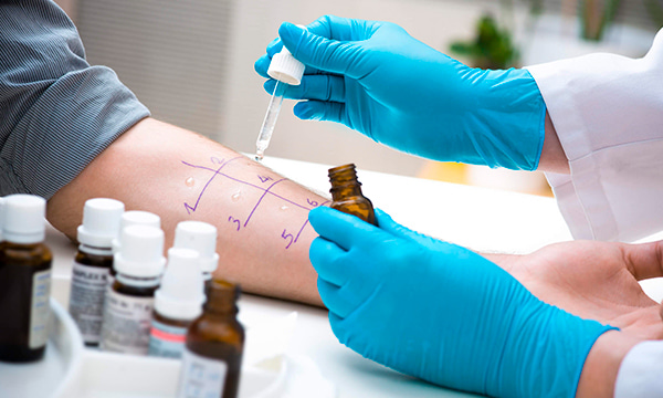 Смесь пищевых аллергенов № 26 IgG (яичный белок, молоко, арахис, горчица)