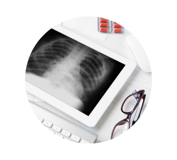 Флюорография