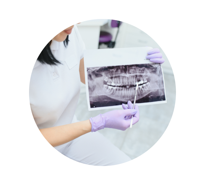 Рентген зубов