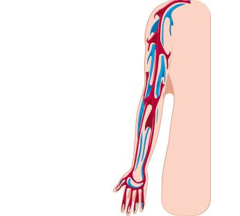 УЗИ вен верхних конечностей