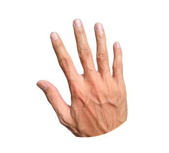 УЗИ сосудов верхней конечности