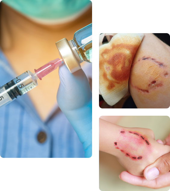 Осложнения после прививки от бешенства Осложнения после прививки от бешенства