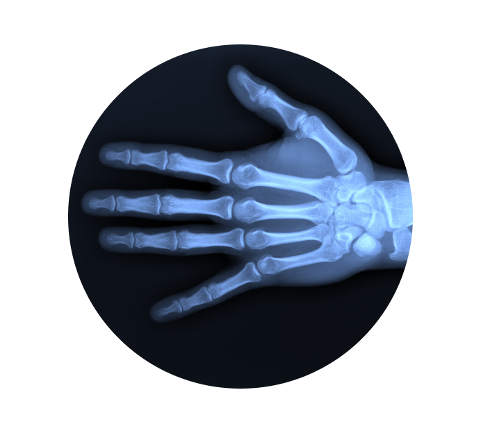 Рентген пальцев