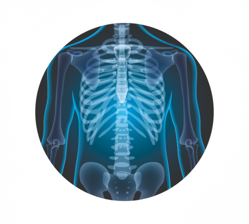 Рентген суставов