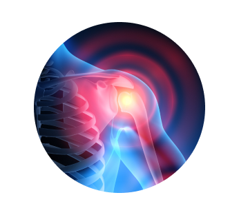 Рентген плечевого сустава