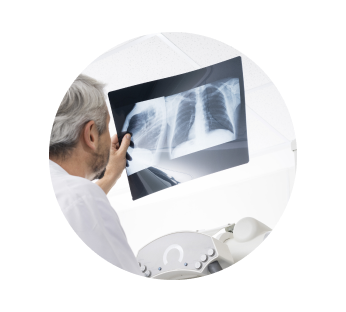 Рентген легких