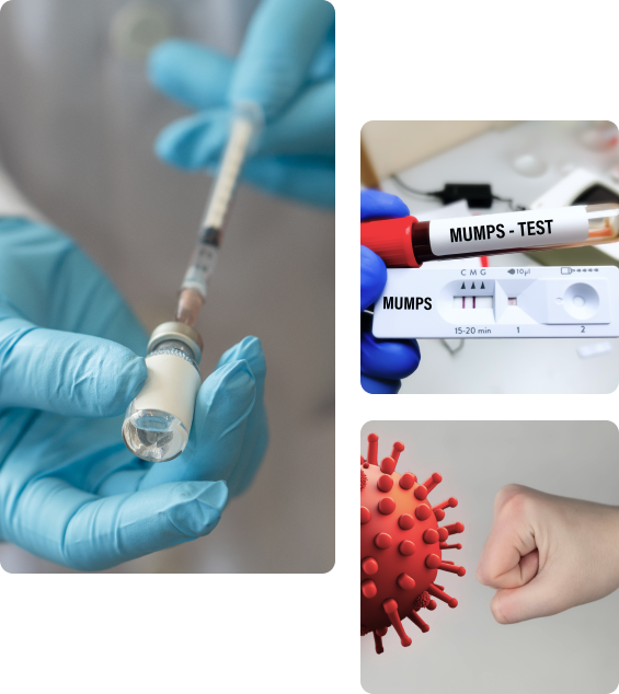 Осложнения после прививки от свинки Осложнения после прививки от паротита