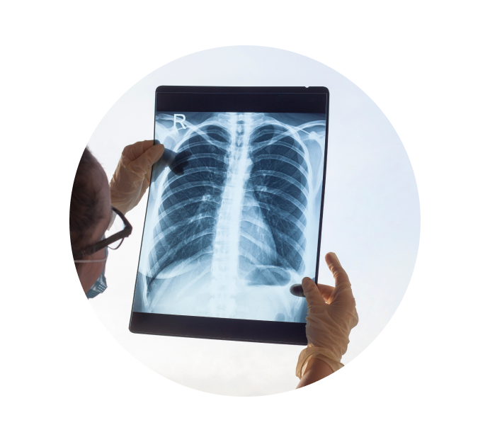 Рентген пищевода с барием