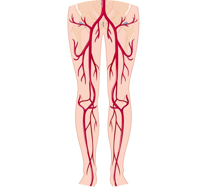 УЗИ сосудов нижней конечности