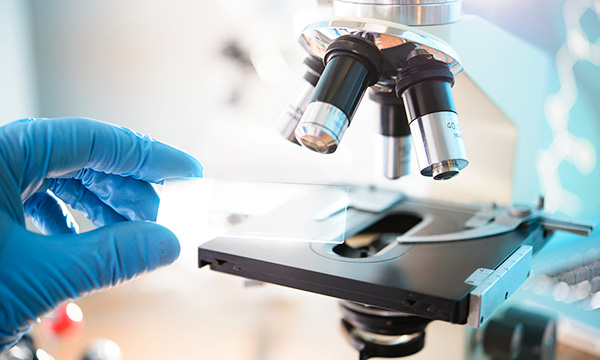 Анализ мокроты