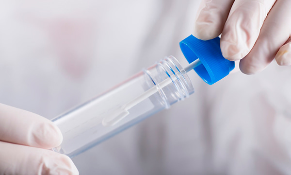 Анализ кала методом обогащения на гельминты