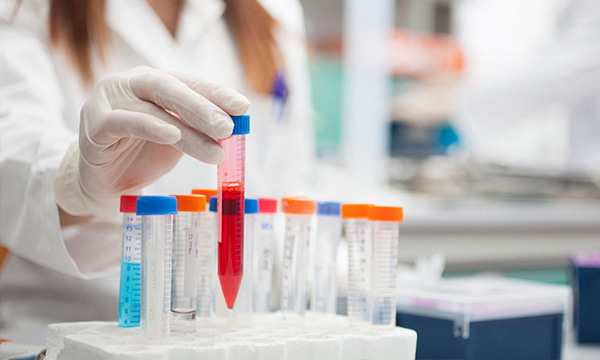 Анализ на иммуноглобулин G в крови Анализ на иммуноглобулин G в крови