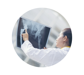 Рентген костей