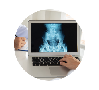 УЗИ эпителиального копчикового хода