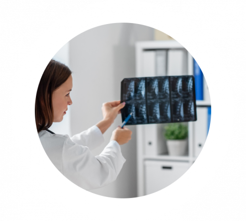 Рентген позвоночника