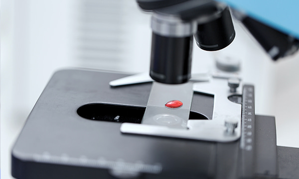 Анализ крови на АСТ