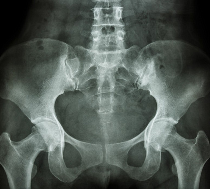 Рентген таза