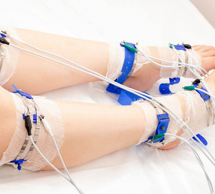 Реовазография