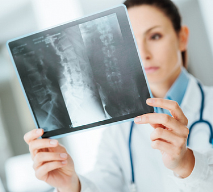 Рентген позвоночника