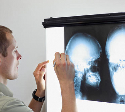 Рентген височно-нижнечелюстного сустава