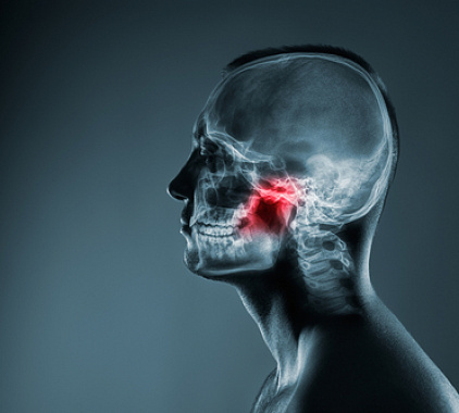 Рентген челюсти