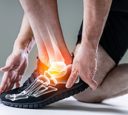 Рентген пяточной кости