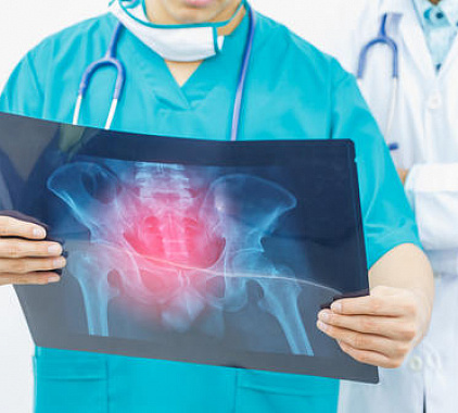 Рентген ТБС