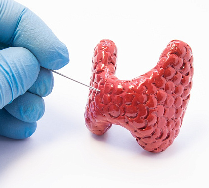 Пункция щитовидной железы