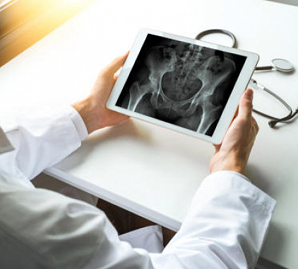 Рентген ТБС