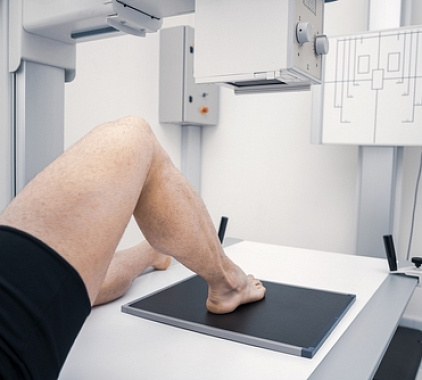 Рентген голеностопного сустава