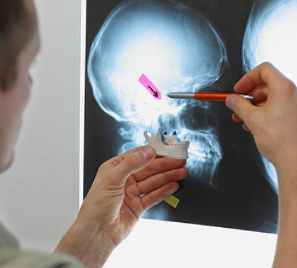 Рентген височно-нижнечелюстного сустава