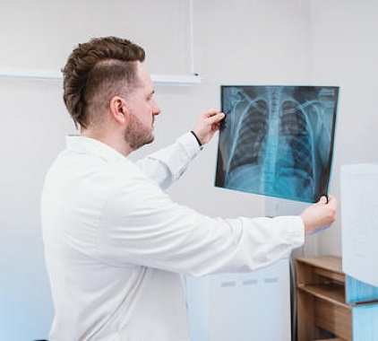 Рентген ребер