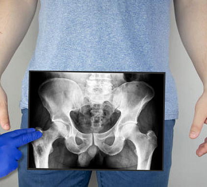 Рентген ТБС