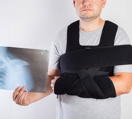 Рентген ключицы