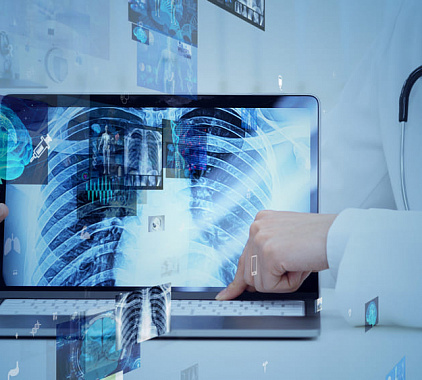 Рентгенография