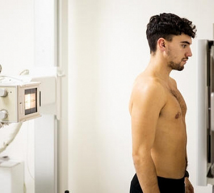 Рентген грудного отдела позвоночника