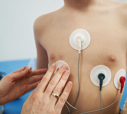 ЭКГ по Небу