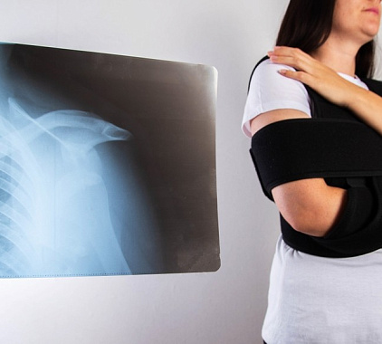 Рентген ключицы