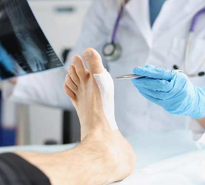 Рентген стопы