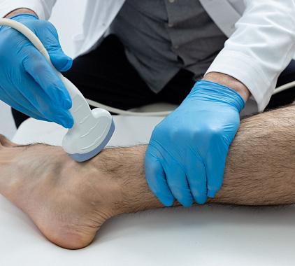 УЗИ голеностопного сустава 1