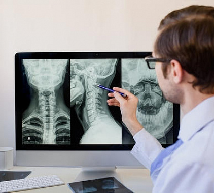 Рентген шейного отдела позвоночника