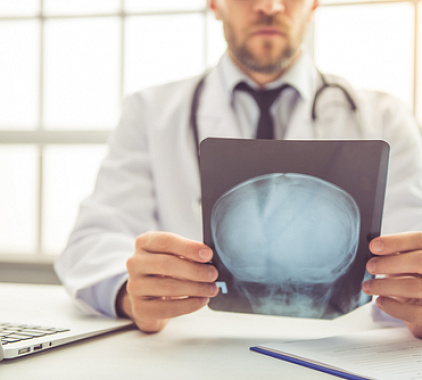 Рентген пазух носа