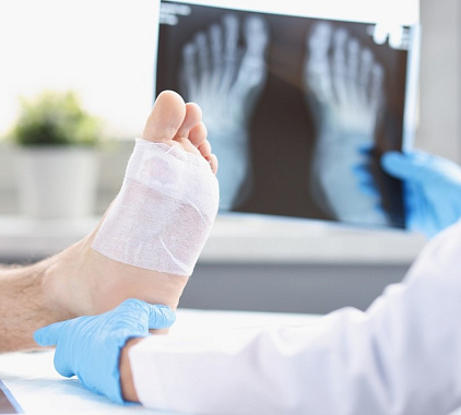 Рентген стопы